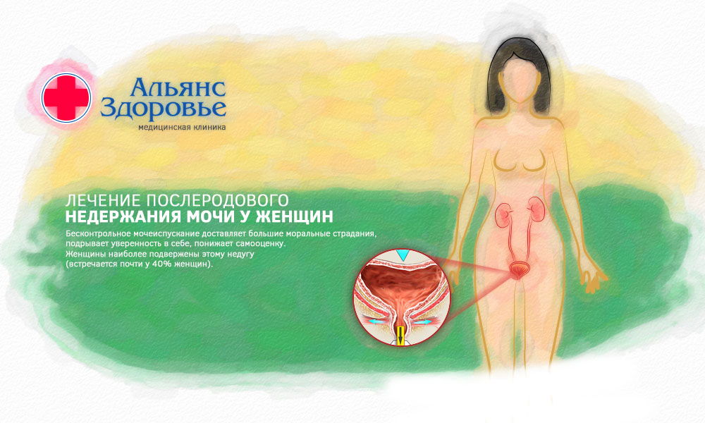 Лечение недержания мочи у женщин после родов в Перми